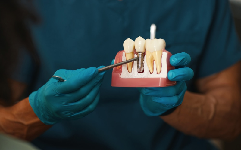 postponing dental implants