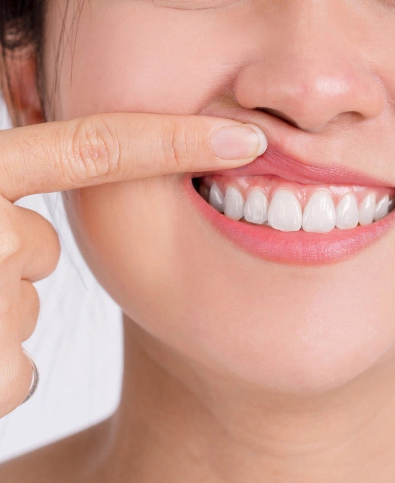 essential advice for periodontal care at city edge dental